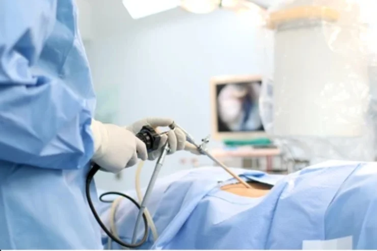 Minimally Invasive Laparoscopic & Endoscopic Surgeries-----11