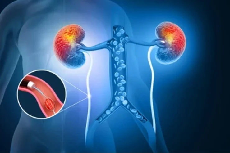 Uro-Oncology